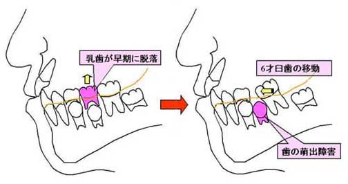 矯正治療